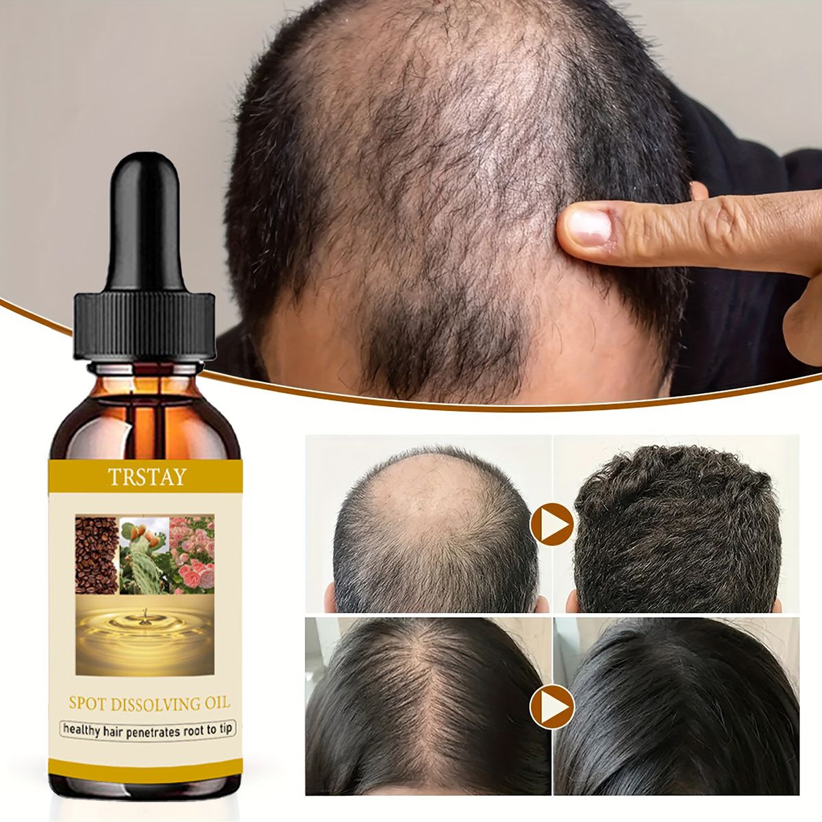 Beard Oil - 50ML 수염 성장 오일 남성 여성을