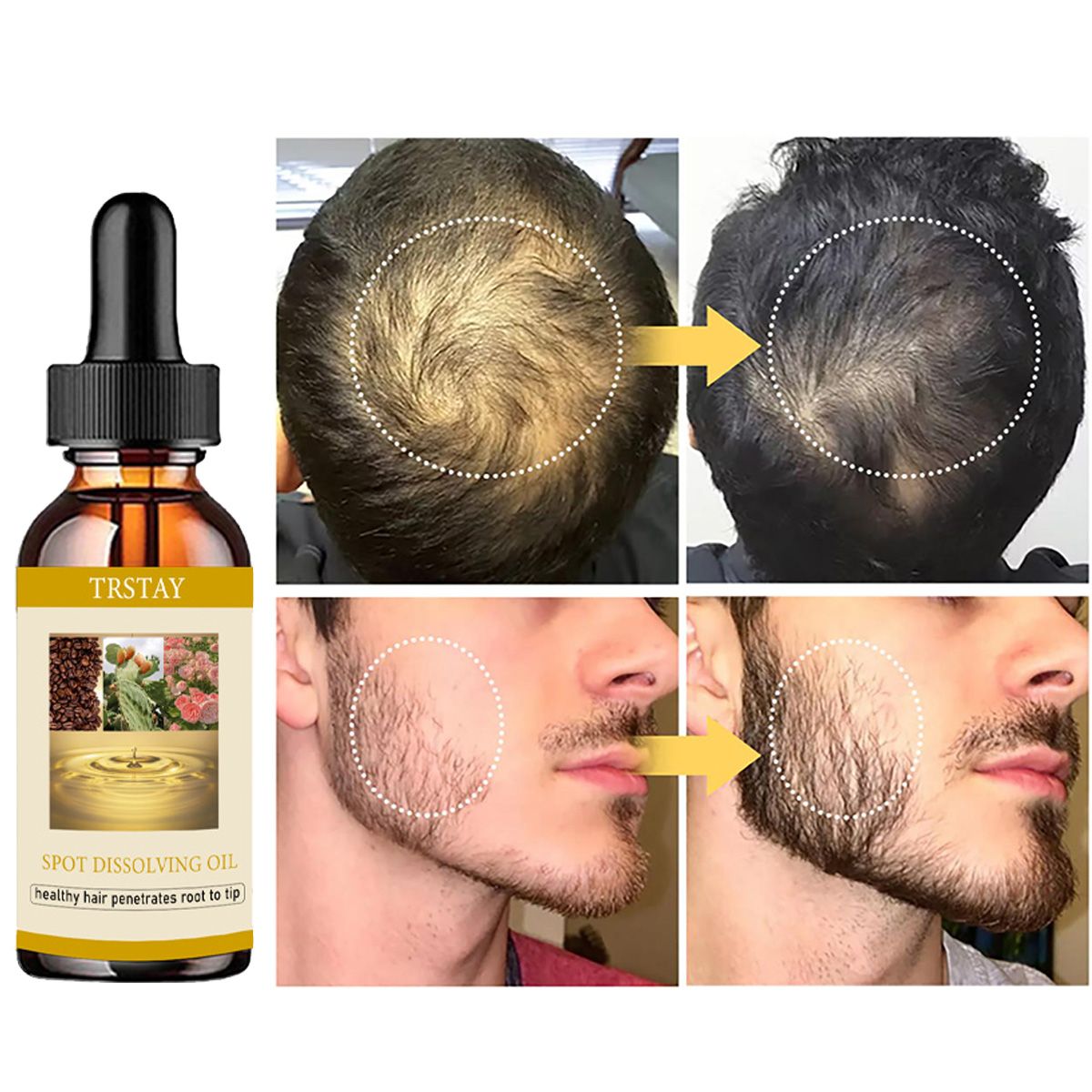 50ML 수염 성장 오일 남성 여성을 위한 탈모증 모발 - Beard Oil 리뷰 및 가격